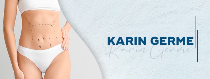 Bauchdeckenstraffung