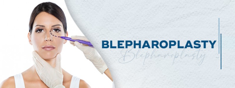 Blepharoplasty