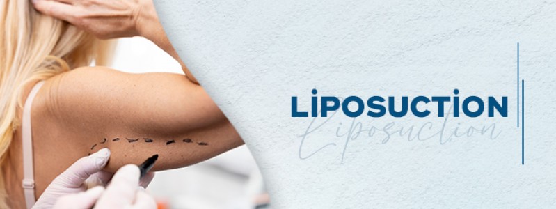 Liposuction