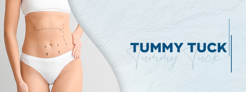 Tummy Tuck